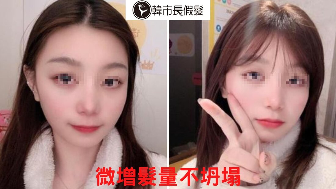 瀏海髮片微增髮片